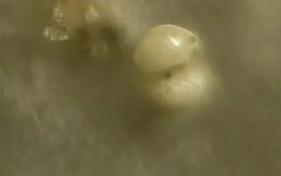 Concrete evidence of the harm to Humans from Chemtrails in Florida